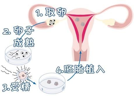 试管包生男孩医院